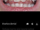 Ужас с зубами