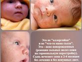 Сыпь...аллергия...Просто УЗБАГОЙТЕСЬ, Мамы ;)