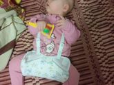 Дисплазия тбс повтор