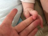 Укусил что-ли((( не пойму.