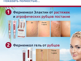 Увидела в интернете мазь