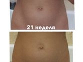 Роста живота не наблюдается?
