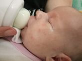 может ли быть аллергия на смесь Нэнни 1
