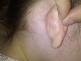 Шишечка за ухом
