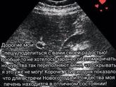А в каком состоянии ваша печень?)))