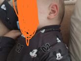 Сильно плоский затылок?