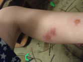 Девчонки, хелп (есть фото, возможно не очень приятные)