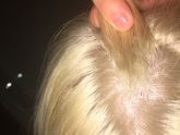 Срочно покрасила корни а сейчас щетина и зуд