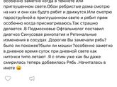 Рябь перед глазами помогите 🙏🏻