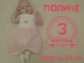 Дисплазия тазобедренных суставов