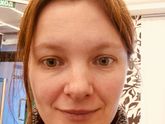 Установка имплантовЗавтра будут ставить