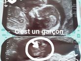 Наши новостя: узи, фоты, сахар.. и пол