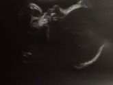 УЗИ