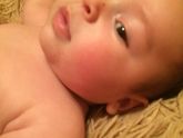 Покраснела одна щека!!