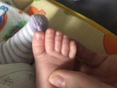 Большой пальчик у сына