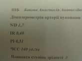 Допплер