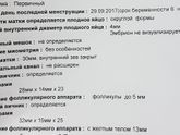 Замершая беременность