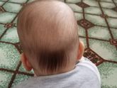Лысики ли у вас малыши на затылке?