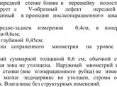 Шов кс через год.