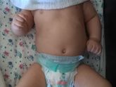 Дневной сон и искривление позвоночника