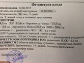 Девочки что скажите по