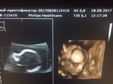 2 скрининг,прием врача и почему то никаких позитивных эмоций