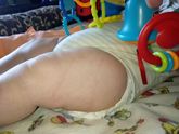 Здравствуйте. Подскажите у кого может такое было？