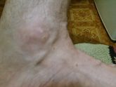 Мужа обкидало (фото)