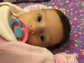 Помнится на УЗИ нам ставили гипоплазию носовой кости.😑