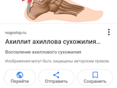 Ахиллит (воспаление ахиллова сухожилия)