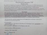Фуууууух... Сделали ЭЭГ(для соо ОР)