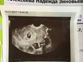 Постановка на учёт.