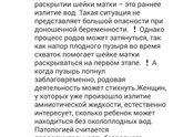 Про амниотомию ( прокол плодного пузыря)