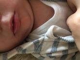 Слюни рекой изза этого сыпь