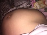 37недель тонус постоянный живот колом