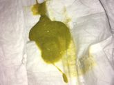 Брезгливые мимо!!!Какашки?