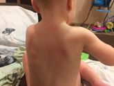 Непонятное покраснение