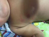 Аллергия или что?