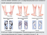 Про ортопедическую обувь.