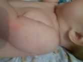 Девочки,видите красное пятно