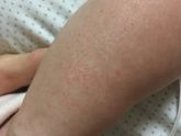 Высыпало сегодня вечером?