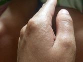 Кто знает что это может быть?! Сыпь!