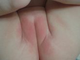 У дочки писюха покраснела ((Интим фото?