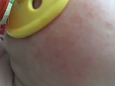 Девочки что это может