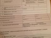 Расширение боковых желудочков.