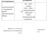 Токсоплазмоз