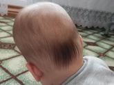 Лысики ли у вас малыши на затылке?