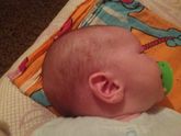 Почему форма головы сзади