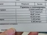 Эстрадиол понижен у ребенка!