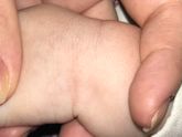 Шершавое пятнышко